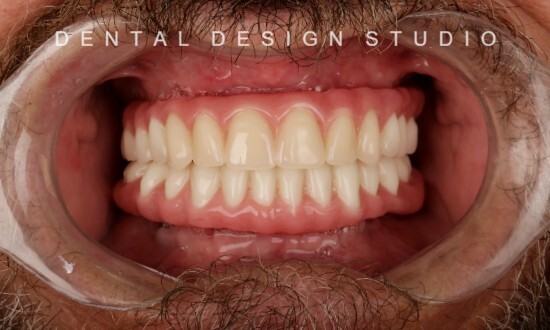 Dentist in cancun